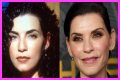 Julianna Margulies Doesn’t Look Natural After Plastic Surgery!