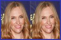 Toni Collette Teeth Before And After | What Is Wrong With Her Face